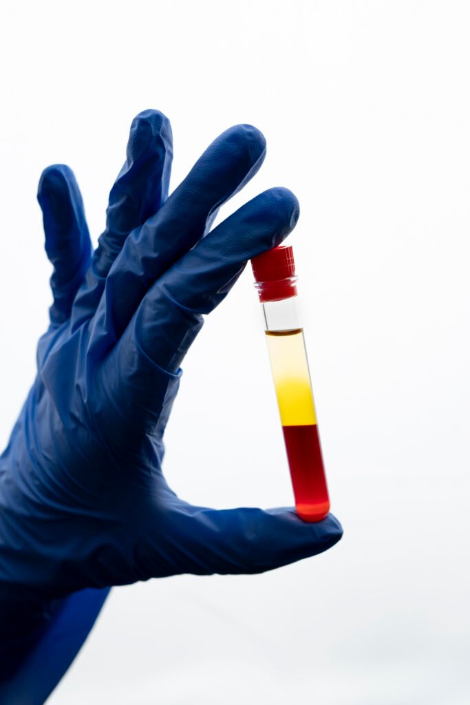 Blood and Urine Test