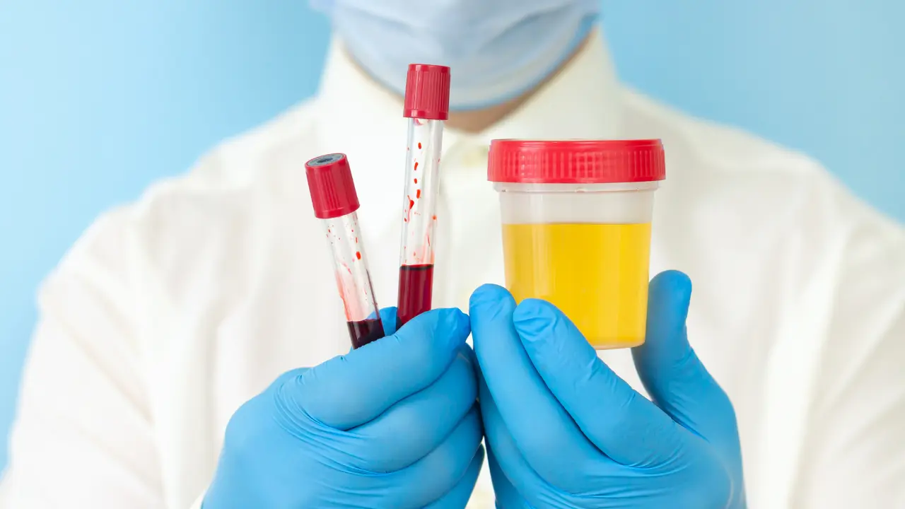 Get Accurate Results with Our Trusted Blood and Urine Test