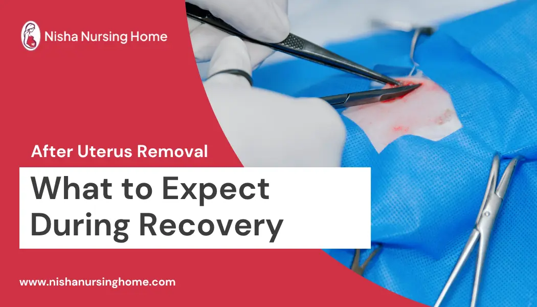 After Uterus Removal What to Expect During Recovery
